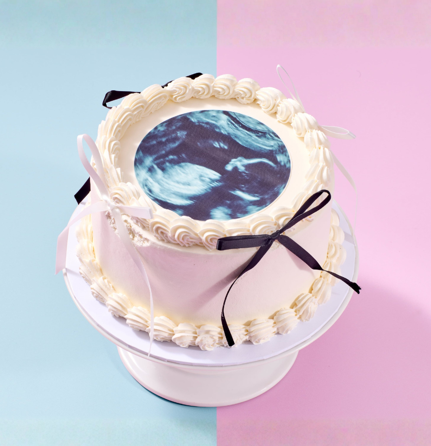 Gender Reveal Ultrasound Cake
