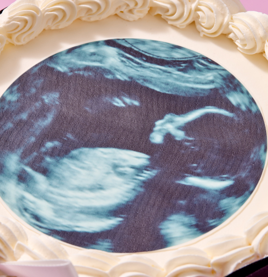 Gender Reveal Ultrasound Cake